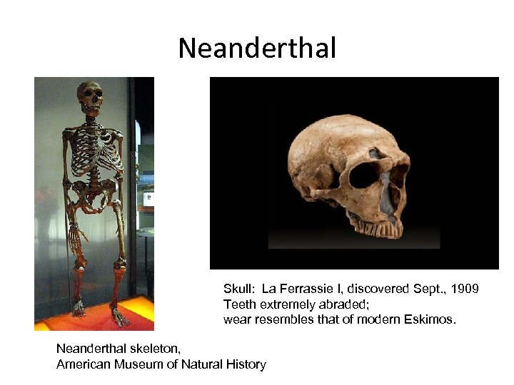 Neanderthal Skull: La Ferrassie I, discovered Sept. , 1909 Teeth extremely abraded; wear resembles