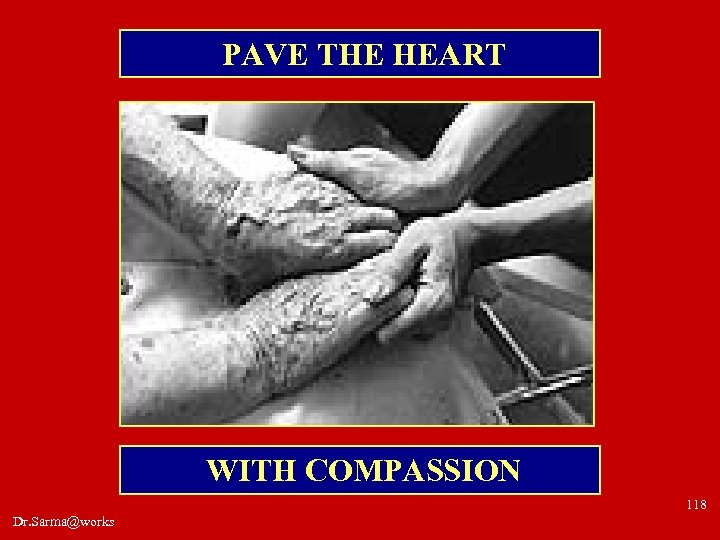 PAVE THE HEART WITH COMPASSION 118 Dr. Sarma@works 
