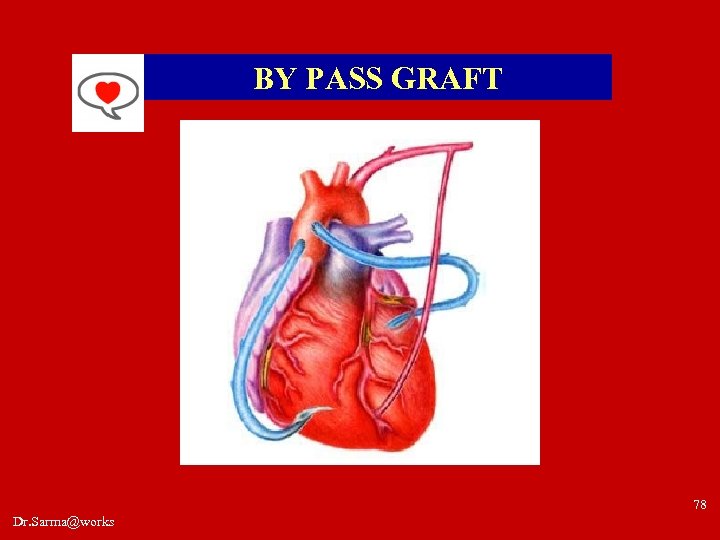 BY PASS GRAFT 78 Dr. Sarma@works 