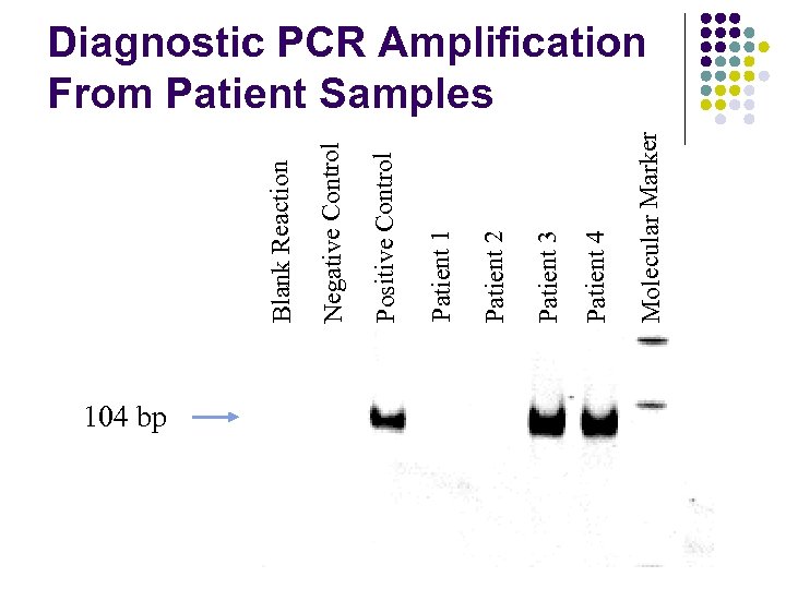 104 bp Molecular Marker Patient 4 Patient 3 Patient 2 Patient 1 Positive Control