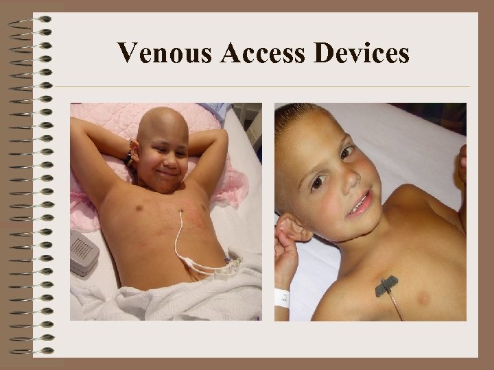 Venous Access Devices 