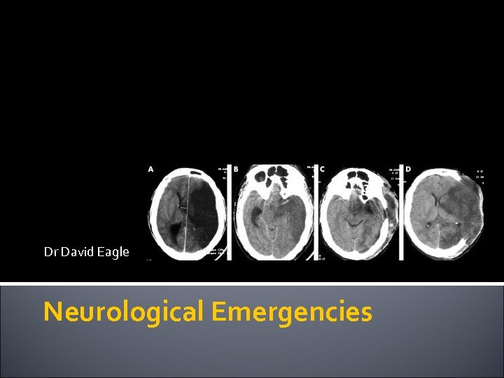 Dr David Eagle Neurological Emergencies 