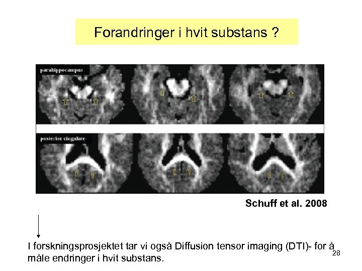 Forandringer i hvit substans ? Schuff et al. 2008 I forskningsprosjektet tar vi også