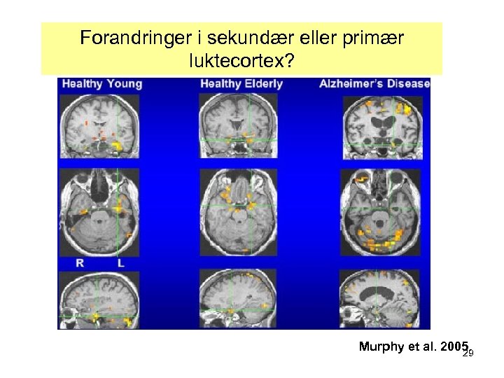 Forandringer i sekundær eller primær luktecortex? Murphy et al. 2005. 29 