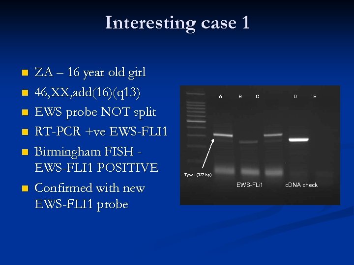 Interesting case 1 n n n ZA – 16 year old girl 46, XX,