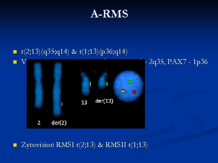 A-RMS n t(2; 13)(q 35; q 14) & t(1; 13)(p 36; q 14) Vysis