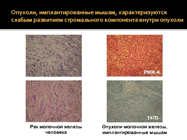 Опухоли, имплантированные мышам, характеризуются слабым развитием стромального компонента внутри опухоли РМЖ-4 T 47 D