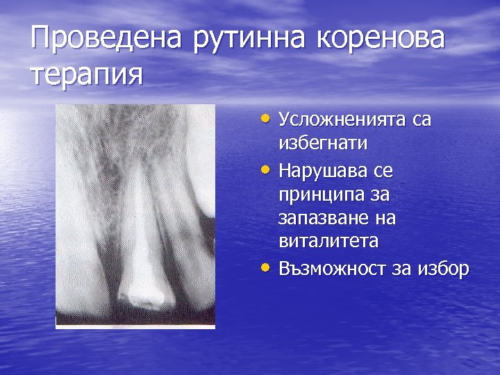 Проведена рутинна коренова терапия • Усложненията са • • избегнати Нарушава се принципа за