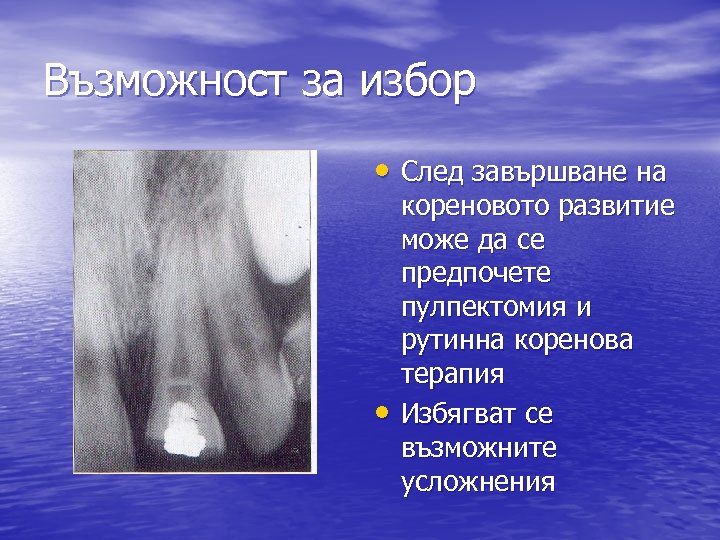Възможност за избор • След завършване на • кореновото развитие може да се предпочете