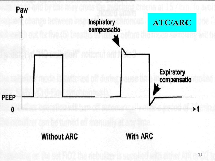 ATC/ARC 31 