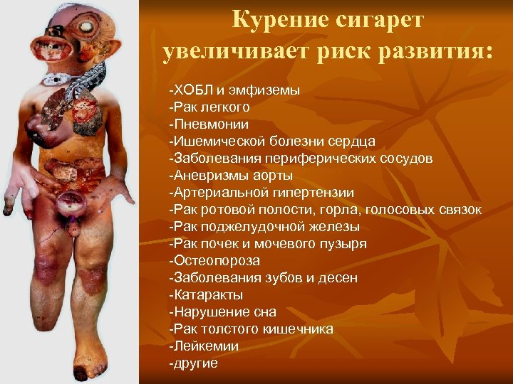 Курение сигарет увеличивает риск развития: -ХОБЛ и эмфиземы -Рак легкого -Пневмонии -Ишемической болезни сердца