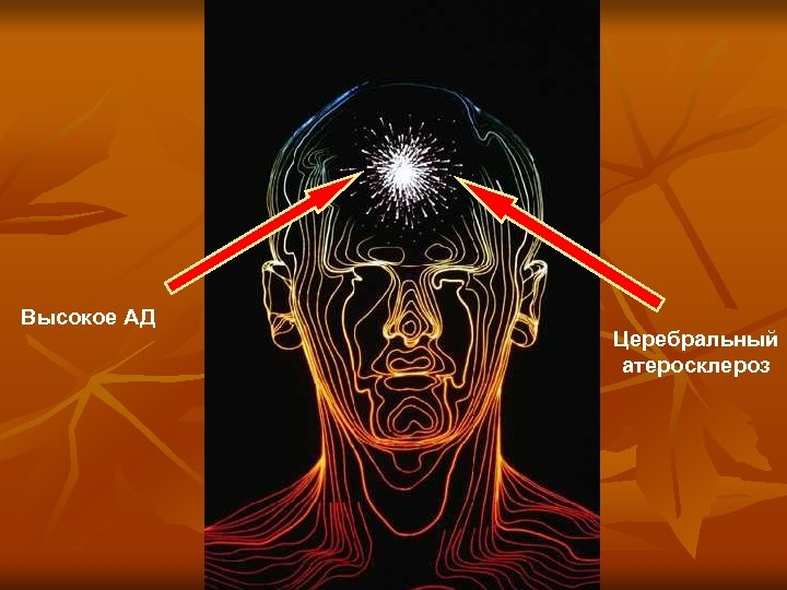 Высокое АД Церебральный атеросклероз 