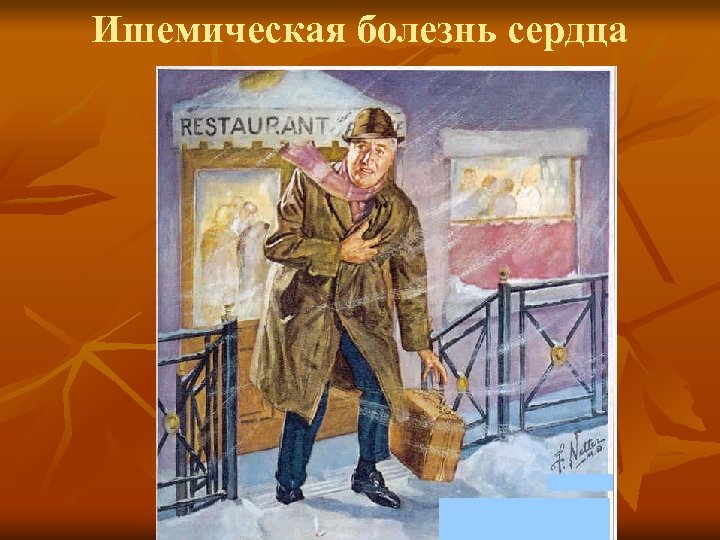 Ишемическая болезнь сердца 