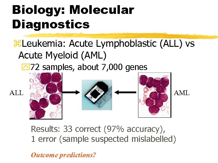 Biology: Molecular Diagnostics z. Leukemia: Acute Lymphoblastic (ALL) vs Acute Myeloid (AML) y 72