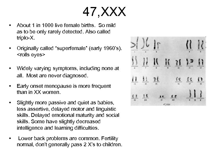 47, XXX • About 1 in 1000 live female births. So mild as to