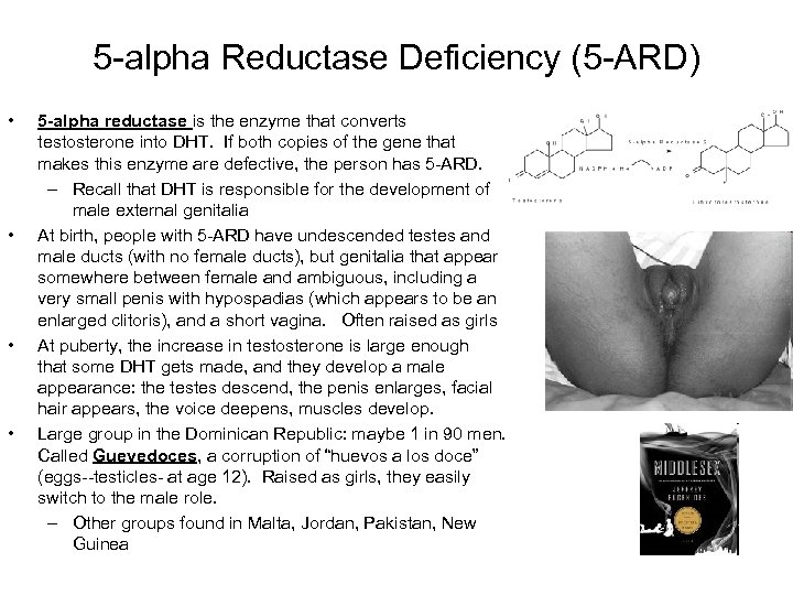 5 -alpha Reductase Deficiency (5 -ARD) • • 5 -alpha reductase is the enzyme