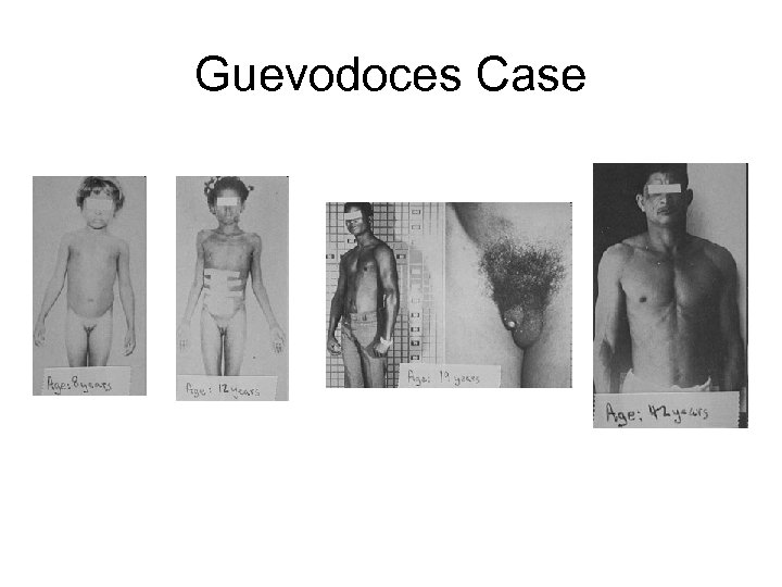 Guevodoces Case 