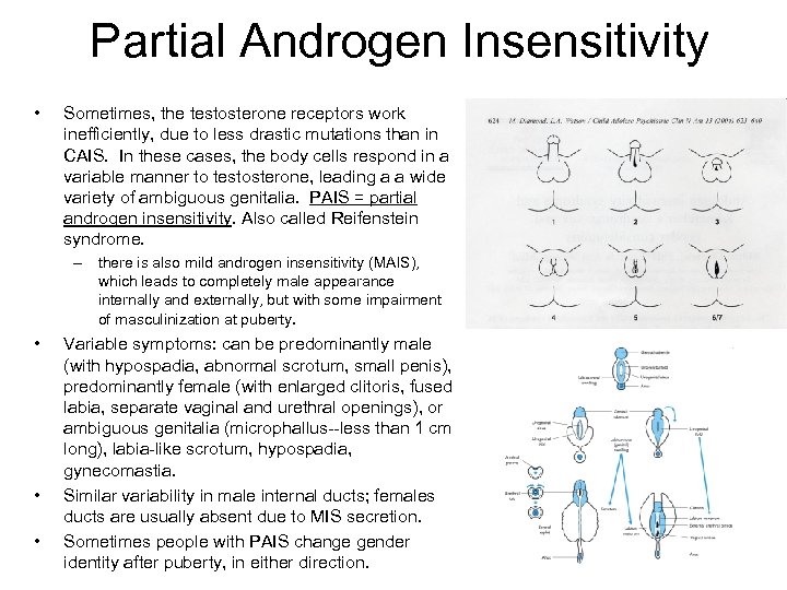 Partial Androgen Insensitivity • Sometimes, the testosterone receptors work inefficiently, due to less drastic