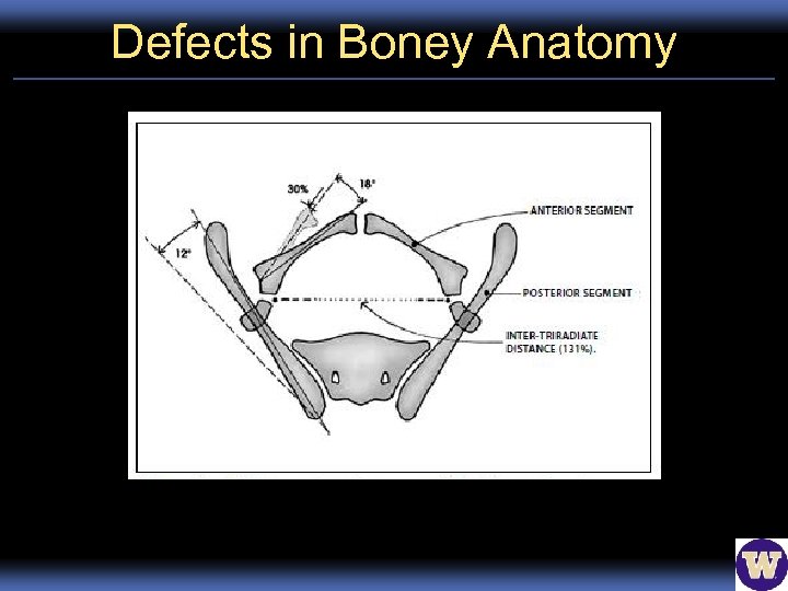 Defects in Boney Anatomy 