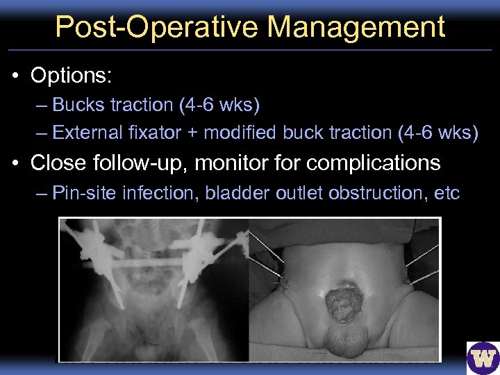 Post-Operative Management • Options: – Bucks traction (4 -6 wks) – External fixator +