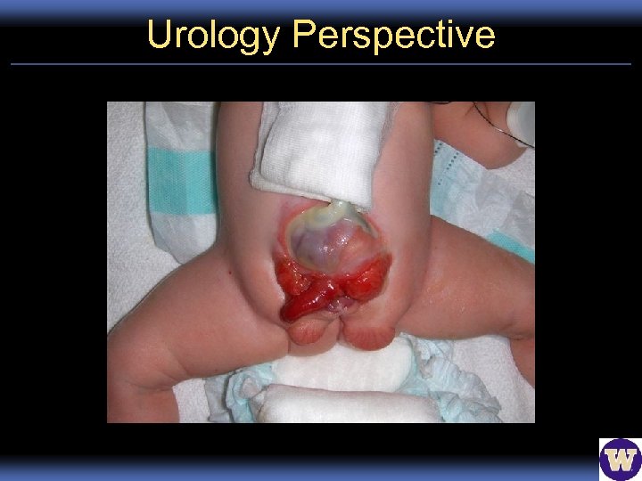 Urology Perspective 