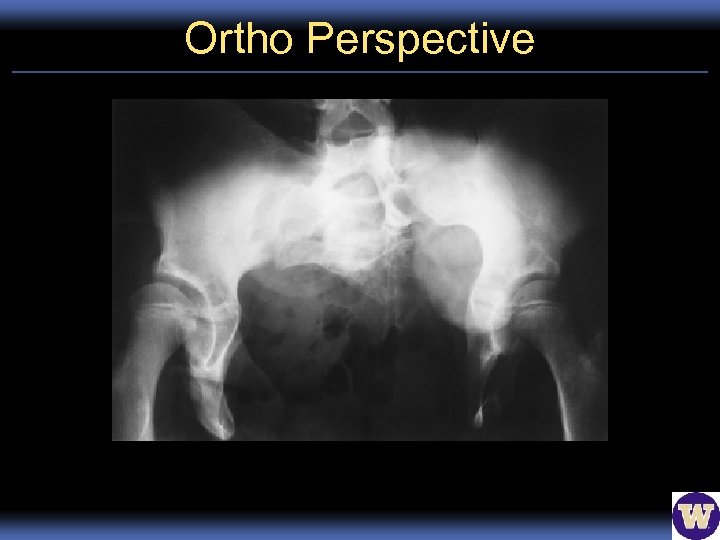 Ortho Perspective 