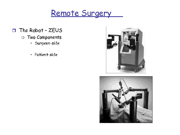 Remote Surgery r The Robot – ZEUS m Two Components • Surgeon-side • Patient-side