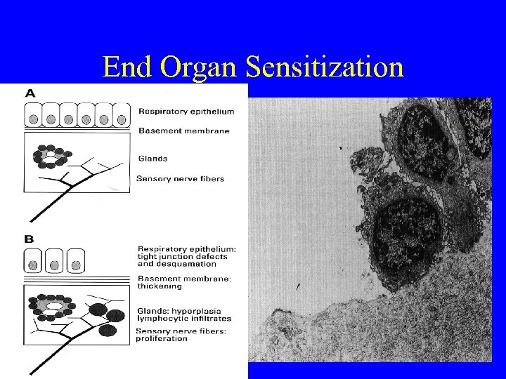 End Organ Sensitization 