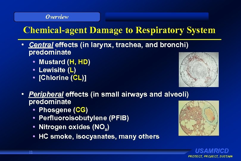 Overview Chemical-agent Damage to Respiratory System • Central effects (in larynx, trachea, and bronchi)