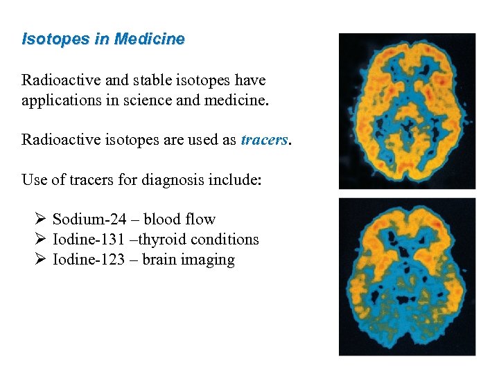 Isotopes in Medicine Radioactive and stable isotopes have applications in science and medicine. Radioactive