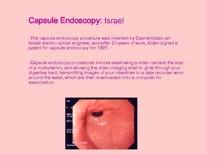 Capsule Endoscopy: Israel -The capsule endoscopy procedure was invented by Gavriel Iddan, an Israeli