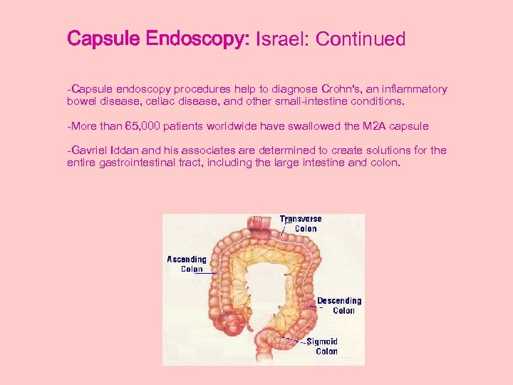 Capsule Endoscopy: Israel: Continued -Capsule endoscopy procedures help to diagnose Crohn's, an inflammatory bowel