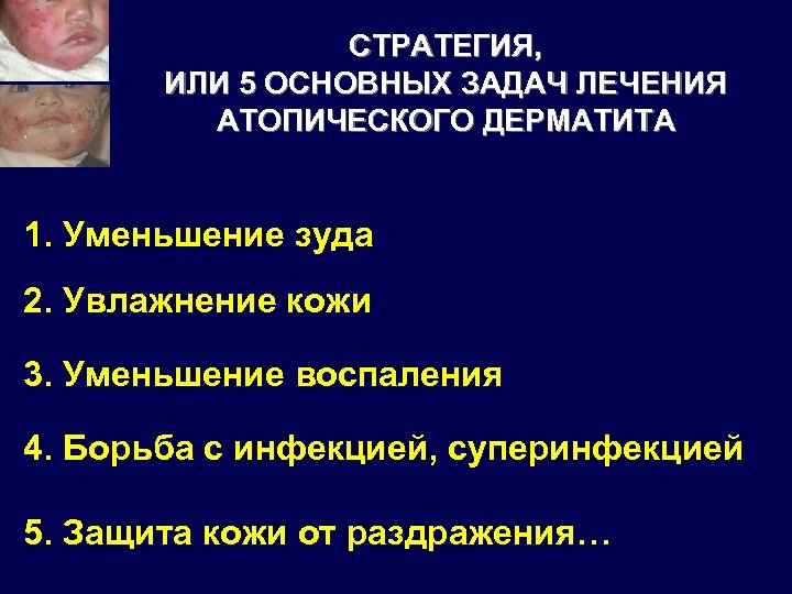 СТРАТЕГИЯ, ИЛИ 5 ОСНОВНЫХ ЗАДАЧ ЛЕЧЕНИЯ АТОПИЧЕСКОГО ДЕРМАТИТА 1. Уменьшение зуда 2. Увлажнение кожи