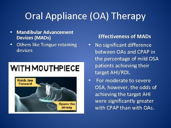 Oral Appliance (OA) Therapy • Mandibular Advancement Devices (MADs) • Others like Tongue retaining
