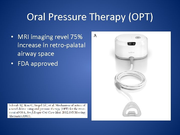Oral Pressure Therapy (OPT) • MRI imaging revel 75% increase in retro-palatal airway space