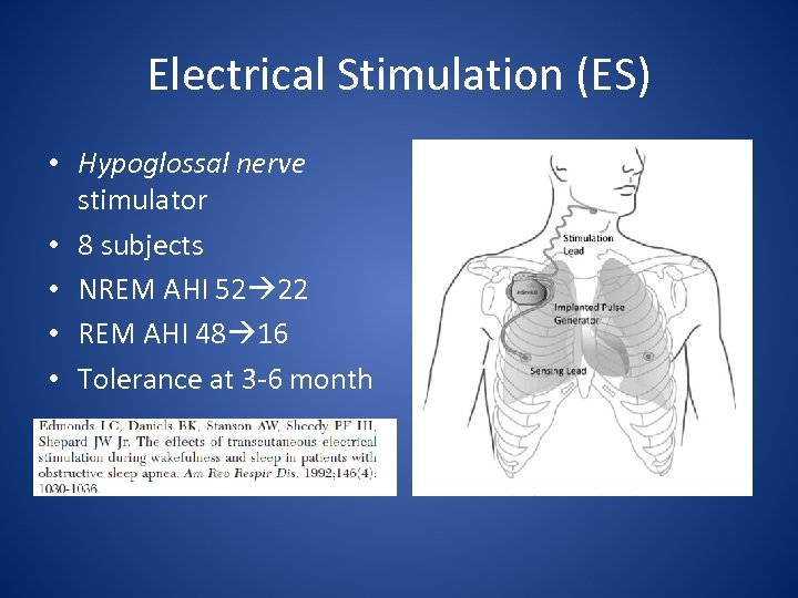 Electrical Stimulation (ES) • Hypoglossal nerve stimulator • 8 subjects • NREM AHI 52