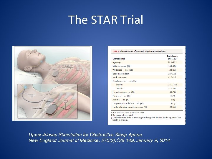 The STAR Trial Upper-Airway Stimulation for Obstructive Sleep Apnea. New England Journal of Medicine.