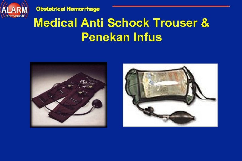 Obstetrical Hemorrhage International Medical Anti Schock Trouser & Penekan Infus 