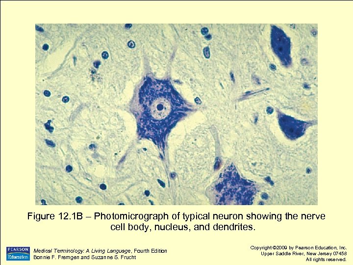 Figure 12. 1 B – Photomicrograph of typical neuron showing the nerve cell body,