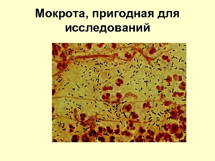 Мокрота, пригодная для исследований 