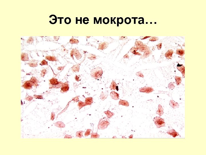 Это не мокрота… 