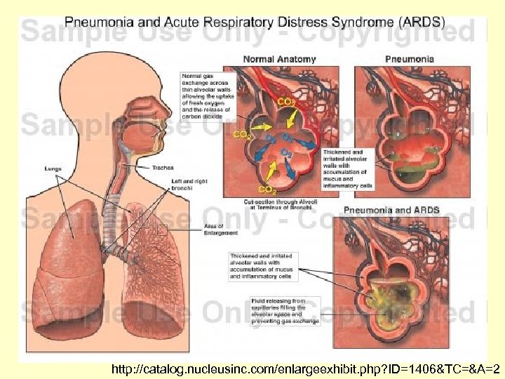 http: //catalog. nucleusinc. com/enlargeexhibit. php? ID=1406&TC=&A=2 