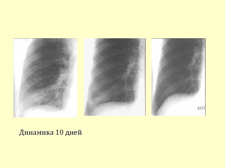 Динамика 10 дней 