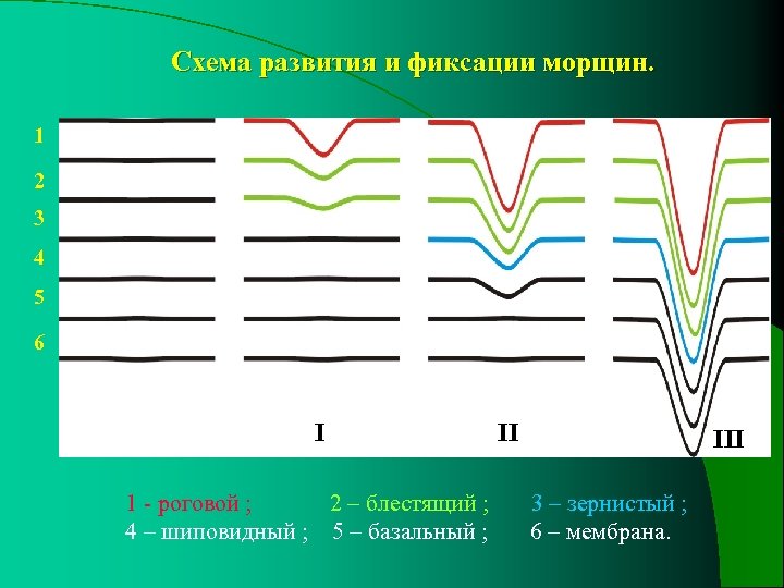 Схема развития и фиксации морщин. 1 2 3 4 5 6 I 1 -