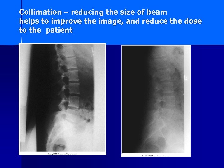 Collimation – reducing the size of beam helps to improve the image, and reduce