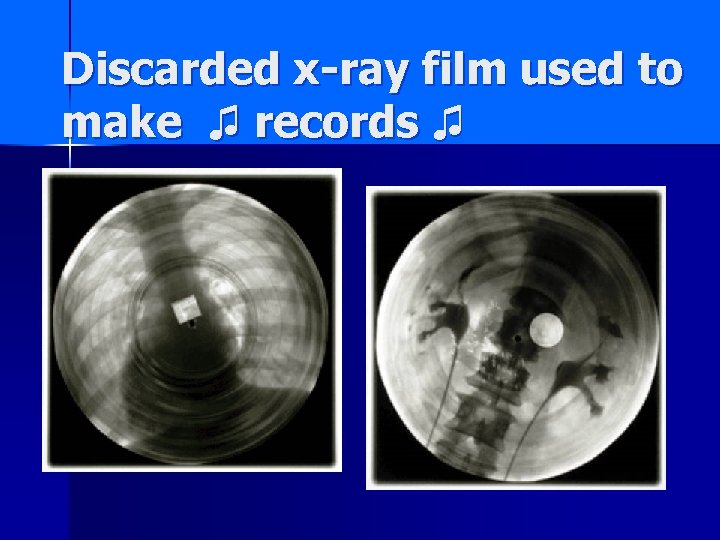 Discarded x-ray film used to make ♫ records ♫ 