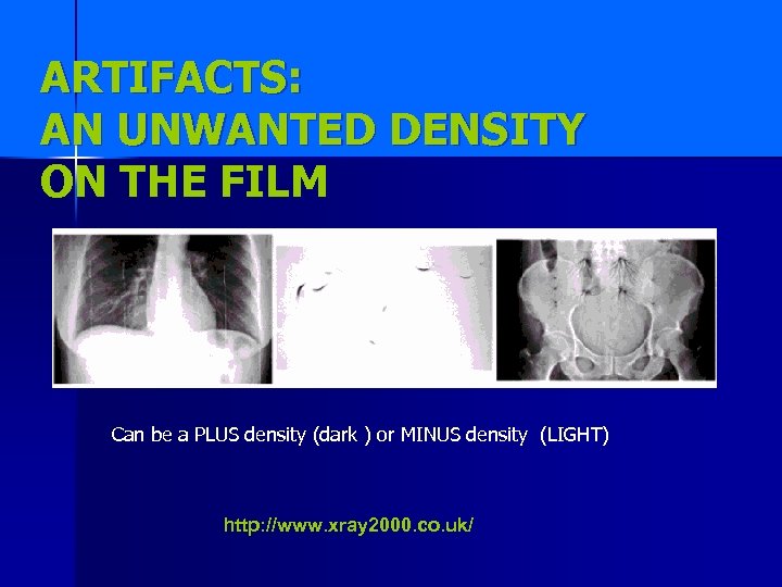 ARTIFACTS: AN UNWANTED DENSITY ON THE FILM Can be a PLUS density (dark )