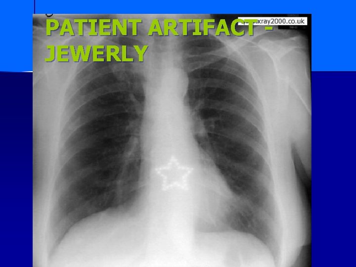 PATIENT ARTIFACT JEWERLY 