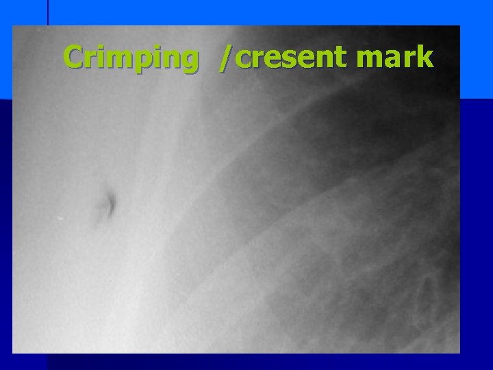 Crimping /cresent mark 