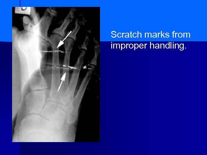 Scratch marks from improper handling. 